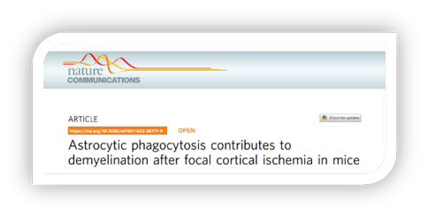 世界预防中风日 | 优发国际助力脑卒中研究
