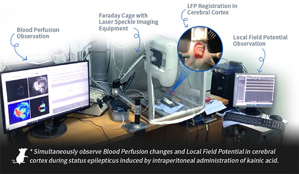 优发国际激光散斑血流成像系统使用分享