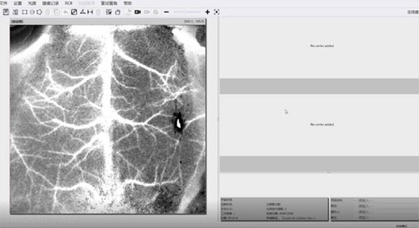 优发国际激光散斑血流成像系统使用分享