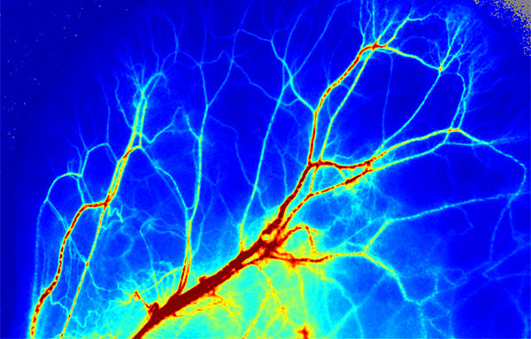 优发国际激光散斑血流成像系统使用分享