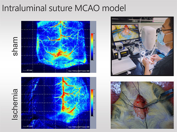 优发国际激光散斑血流成像系统使用分享