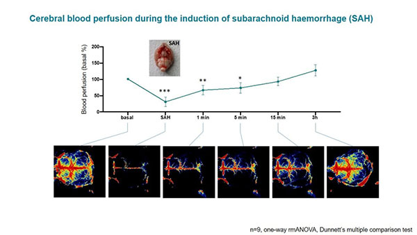 优发国际激光散斑血流成像系统使用分享