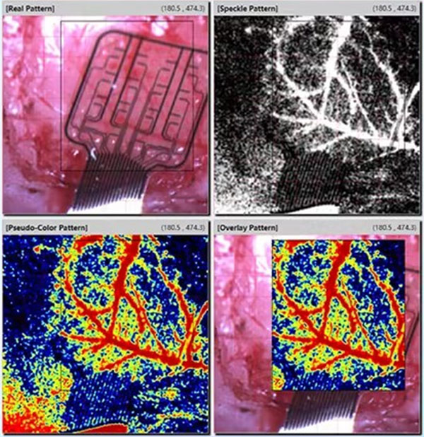 优发国际激光散斑血流成像系统使用分享