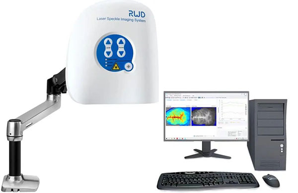 优发国际激光散斑血流成像系统